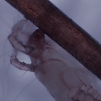 髪の毛を食べるダニ